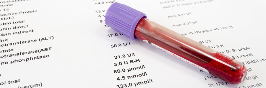 Blood - What gets tested and why